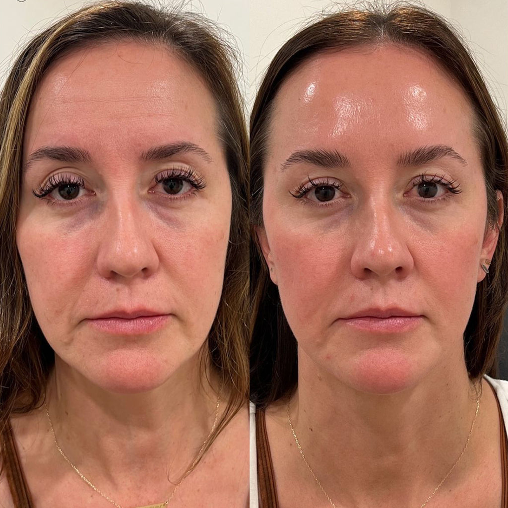 Mousse Nettoyante Perfect Skin - Saba beauté